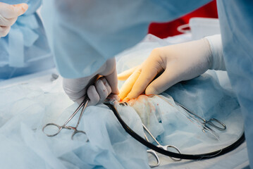 Operation in a modern operating room close-up, emergency rescue and resuscitation of the patient. Medicine and surgery