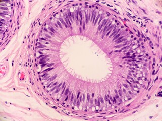 Tubules of the epididymis lined by ciliated epithelial cells and containing a few sperm which look...