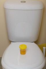 Urine in a container for analysis. Stands on the toilet lid. Disposable medical polymeric sterile container with a built-in holder for a vacuum test tube with a screw cap.