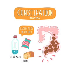 Illustration of the foods with low fiber content. 
Large intestine with fecal masses, intestinal obstruction.
Vector illustration of constipation