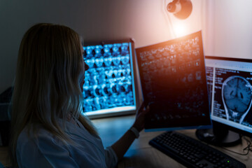 Doctor holding a picture of a brain MRI workflow in diagnostic hospital. Healthcare, roentgen,...