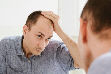 Young man looking at mirror worry about balding.