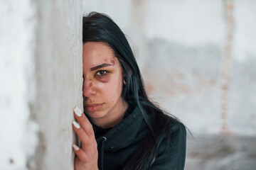 Portrait of beaten young woman with bruise under eye that standing and leaning on the wall indoors...