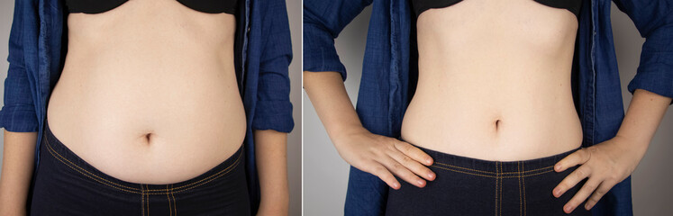 The girl shows the results of work on the body. Before and after a thick and thin waist. In the photo on the left, belly fat is visible. In the photo on the right, a thin waist without extra kilograms