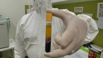 Close up view of a doctor or medical scientist in a laboratory wearing bio protective suit, face mask, face shield and gloves taking and showing up a blood sample in a test tube