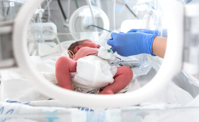Photo of a premature baby in incubator. Focus is on his feet. Nurse in blue gloves is using the...