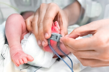 Nurse is putting on the foot of neonatal premature infant pulse oximeter for premature babies,...