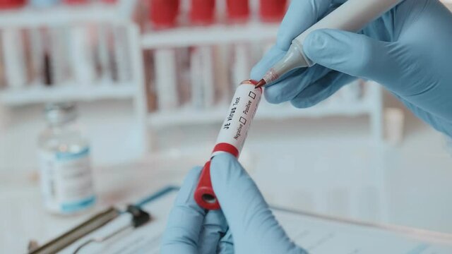 Doctor or laboratory technician holds in one hand laboratory positive blood test tube for JE virus, other hand writing down results to patients medical record. Laboratory medical diagnostics