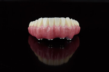 High-quality dental prosthesis made by dental technician, prosthesis with a pink gingiva to fix after implantation.