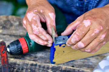 Hands of the master with defects and spots with a drill and a product
