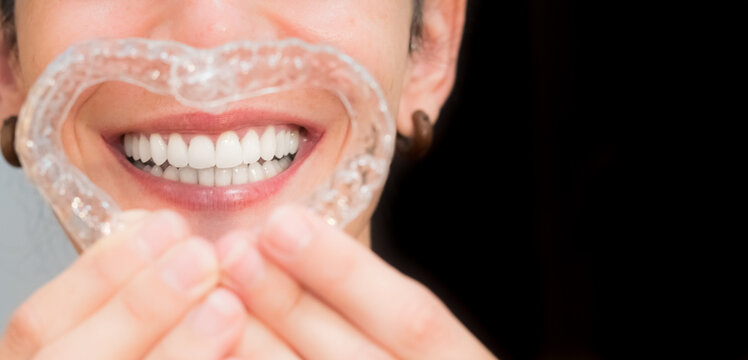 smiling woman making a heart with her invisible aligners for dental correction. mobile orthodontic