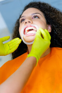 Mixed-race Teenage Girl With Dental Cheek Retractor In Her Mouth And Dentist's Hands Checking It