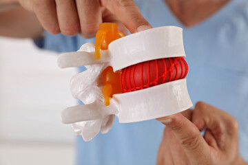 Back pain relief concept. Doctor chiropractor explains causes of back pain lumbar spine disk model