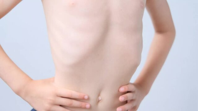 kid, a boy of primary school age with a naked torso, slender structure, ribs, belly, the concept of children's health, happy childhood