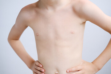 Fototapeta na wymiar kid, a boy of primary school age with a naked torso, slender structure, ribs, belly, the concept of children's health, happy childhood