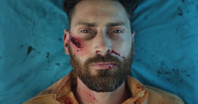 Top view of bearded guy with blood and head wound riding to hospital. Close up of injured caucasian man lying on medical transportation cart in ambulance. Concept of healthcare