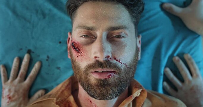 Top view of paramedics transportating bearded man with blood and head traumas in ambulance. Close up of guy in 30s mumbling while lying on medical stretcher on way to hospital