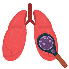 Magnifying glass and tuberculosis. The structure of the lungs