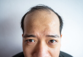 Closed portrait of Asian man with sweating on his forehead cause of hot weather or etc.