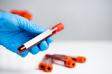 Technician holding blood tube test in the research laboratory