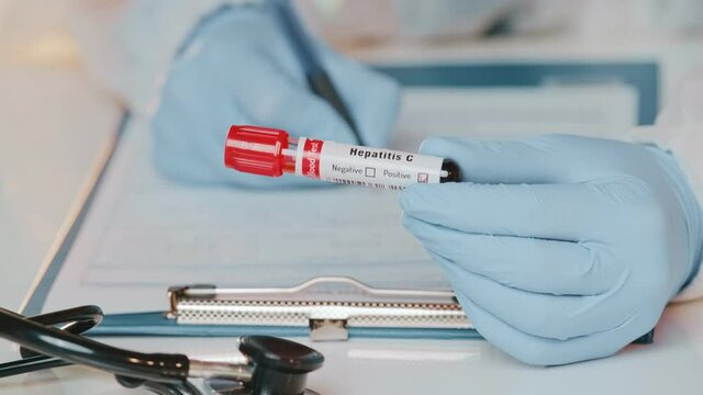 Doctor holds in one hand laboratory holds blood sample positive with hepatitis C virus label, other handwriting down results to patients medical record. Laboratory medical diagnostics