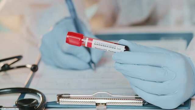 Close up of doctors hand holding tube with positive blood test for Coronavirus, other hand writing down results to patients medical record, focus on blood sample tube for diagnosis infection.