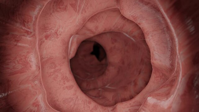 Animation of a Enteroscopy of the human intestines