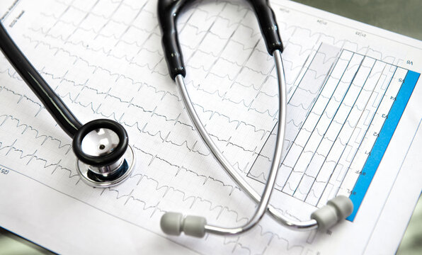 From above of medical stethoscope with stainless steel and plastic parts on paper sheet representing cardiogram with wavy lines in doctor office in hospital