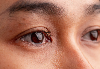 Close up of Asian woman crying with tear and little freckles on her beautiful face.