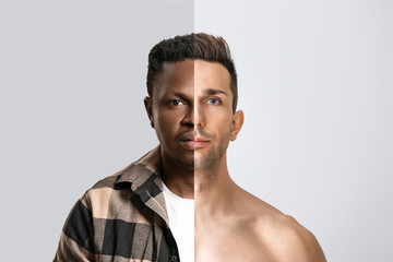Obraz premium Handsome young man on light background. Plastic surgery concept