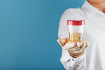 A doctor in a white coat holds a plastic container with yellow urine in his hand.