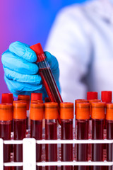 Doctor hand taking a blood sample tube from a rack in the lab
