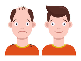 Flat vector illustration: man with bald head and man with thick hair. Hair transplant concept. Hair loss concept.