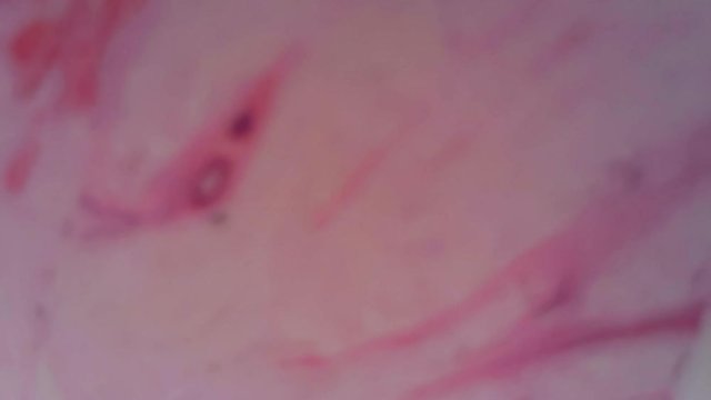 Microscope Human Skin Sweat Gland 1200x Slides Moving