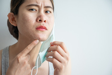 Asian woman worry about acne occur on her face after wearing mask for long time during covid-19...
