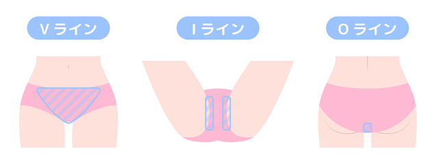 脱毛箇所　VIO　デリケートゾーン　インナー着用