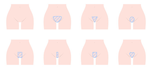 アンダーヘア　デザイン　バリエーション