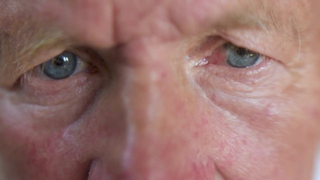 Eyes of a sad senior caucasian man. Up close view of older mans watering eyes.