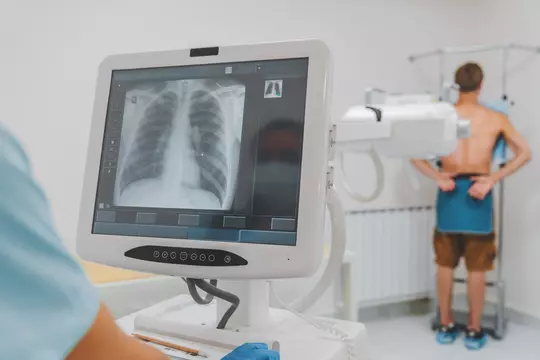 In-Office Digital X-rays