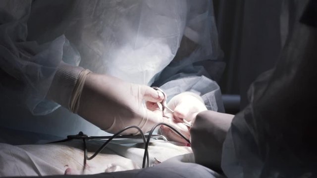 Healthcare workers doing male enhancement surgery. Action. Close up of penis enlargement surgery in operating theater, concept of sex health medicine.