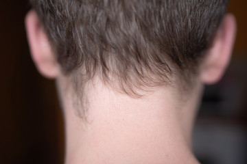 Obraz premium View from the back of a man with uncropped hair. Adult man with short hair on his back. Adult man with a sloppy hairstyle and a neck overgrown with hair.