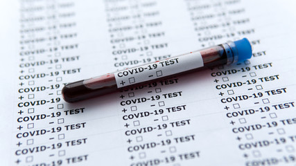Obraz premium Test tube with blood sample for COVID-19, isolated on white paper with text. Coronavirus test. There is no mark that is positive or negative test result from Coronavirus Covid-19. A blood test.