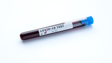 Test tube with blood sample for COVID-19, isolated on white background. Coronavirus test. Positive...