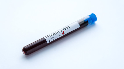 Negative test result from Coronavirus Covid-19. Isolated test tube with blood sample for COVID-19. Coronavirus test. A blood test for the presence of the virus. Medical concept.