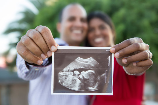 Happy couple holding sonogram