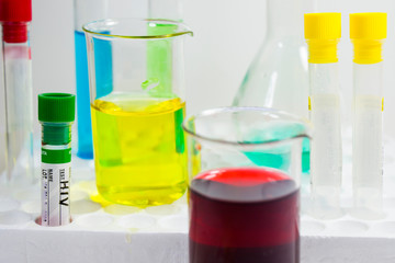 HIV test blood tube and laboratory glasses, instruments and viruses research