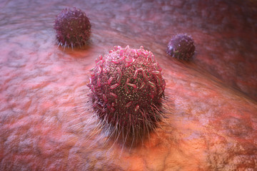 Red cancer cells