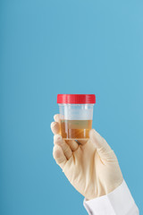 The doctor's gloved hand holds a transparent container with a urine test.