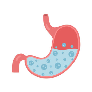 Stomach acid reflux concept vector illustration on white background. Human stomach with gastric acid in flat design. Stomachache diagnosis. Digestion problem.