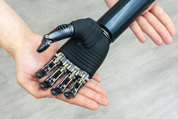 Bionic hand. Modern technology prosthetic limbs. Manufacturing of artificial limbs from...